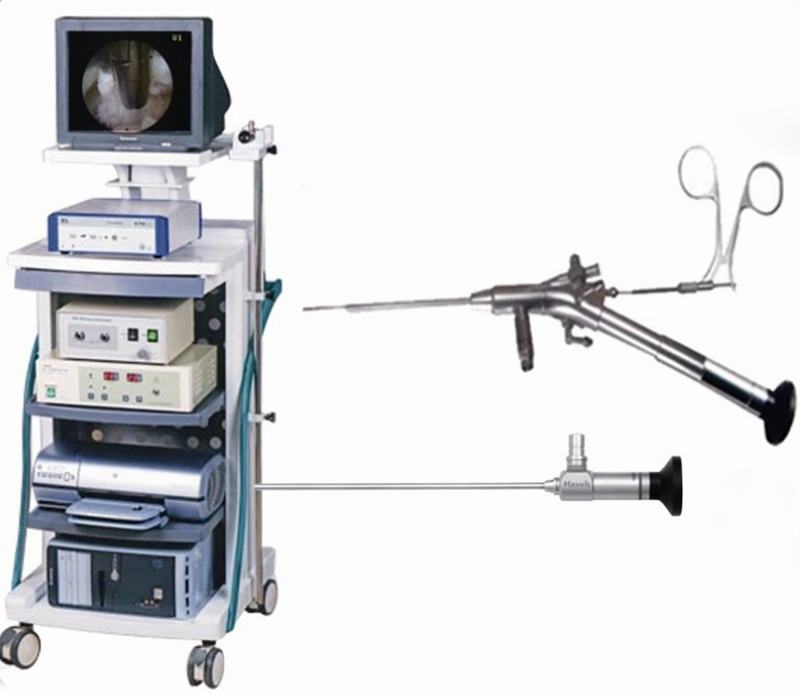 椎间孔镜手术系统